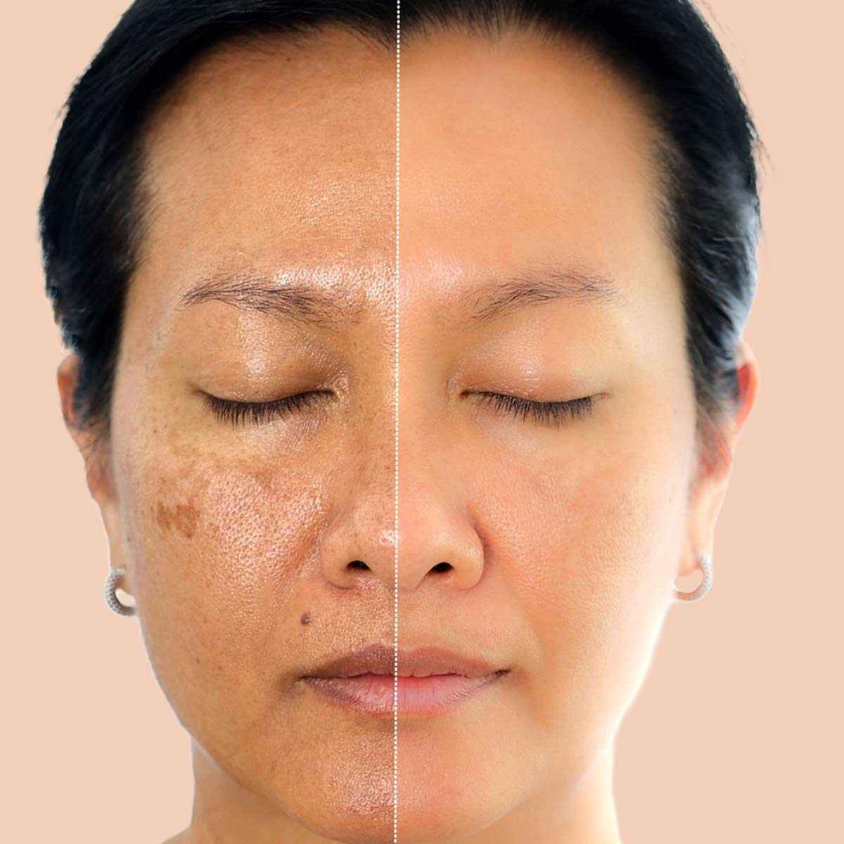 ageing